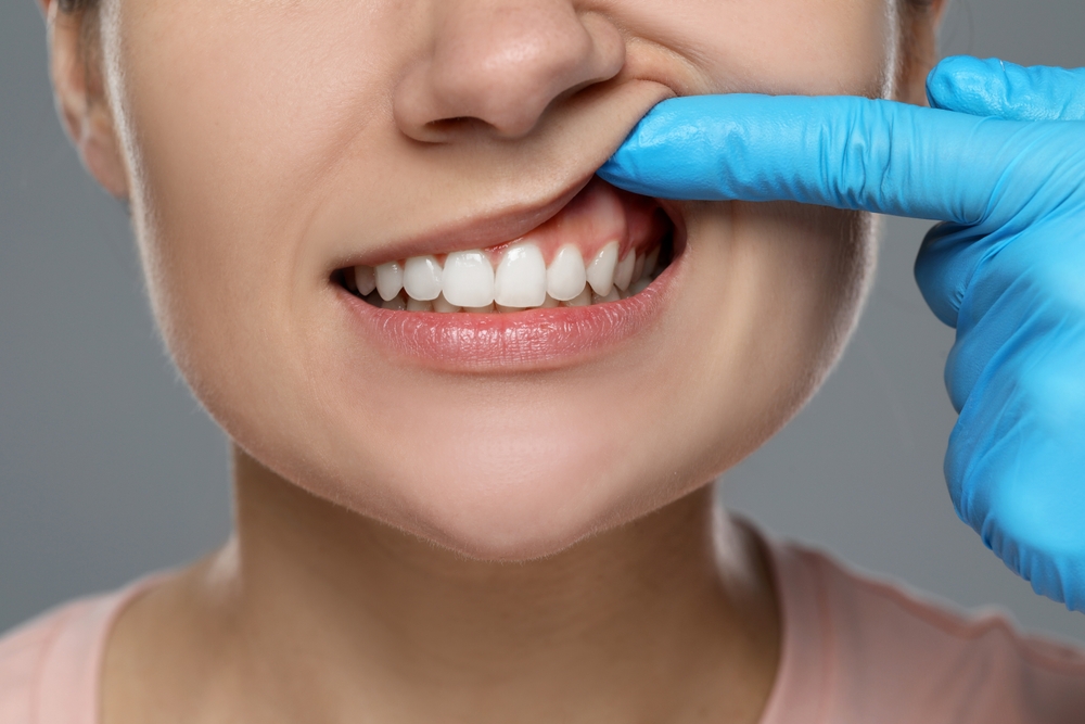 Periodontal Care Vancouver